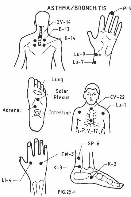 acupuncture points constipation